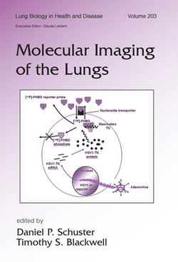 Molecular Imaging of the Lungs|Daniel Schuster
