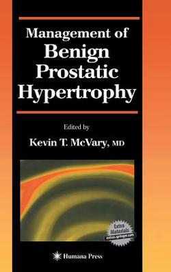 Management of Benign Prostatic Hypertrophy|Kevin T. McVary