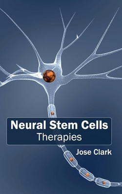 Neural Stem Cells|Jose Clark