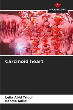 Carcinoid heart|Leila Abid Trigui